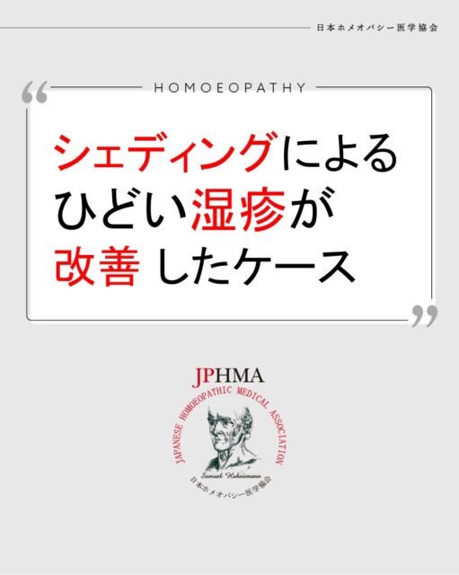 本ケースは2025年に開催された第26回JPHMAコングレスへ増田敬子ホメオパス（日本ホメオパシーセンター熱海伊豆山）より寄せられた「シェディングによる酷い湿疹がお水のレメディーやQX-SCIOで改善したケース」をまとめたものです。
より詳しくは「JPHMAコングレス」特設サイトより「10/19（日）第26回JPHMAコングレス2日目・午前の部（56:37あたりから）」でご視聴いただけます。

このインスタグラムでは左腕の写真のみですが、本編は全身の湿疹の変化が写真とともに分かります。
ぜひ本編をご覧ください。
そして同様の問題にお困りの方はZENホメオパシーを選択肢の一つとしてご検討ください。

#シェディング 　#湿疹改善 　#ひどい痒み 　#ホメオパシー #jphmaコングレス2025 　#コロナワクチン後遺症