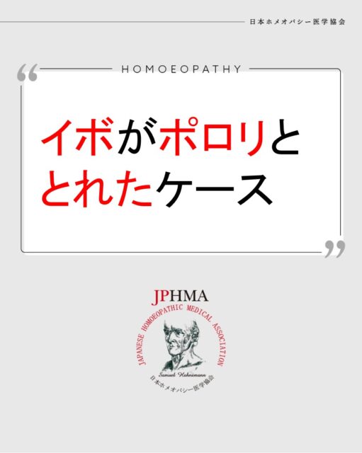 本ケースは2025年に開催された第26回JPHMAコングレスへ水野朋子さん（CHhom学生）より寄せられた「疣がポロリととれたケース」をまとめたものです。
詳細は「JPHMAコングレス」特設サイトhttps://cong.jphma.org/26th/26th-web_mizuno-tomoko/をご覧ください。

イボは薬を塗ったり、切除したり、窒素で焼いたりして取り除く治療法では
繰り返すことがよくあります。ホメオパシーでイボを作る体質を改善するとともに自己治癒力で内側からイボを排出してしまえば再発もしなくなります。
ぜひ同様の問題にお困りの方はZENホメオパシーを選択肢の一つとしてご検討ください。

#いぼ 　#イボ 　#疣 　#うおのめ除去 　#ホメオパシー #jphmaコングレス2025