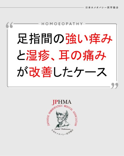 本ケースは2025年に開催された第26回JPHMAコングレスへ榎本仁美ホメオパス（日本ホメオパシーセンター三重津）より寄せられた「カンジダにアプローチすることで、足指間の強い痒みと湿疹、飛行機に乗った際の耳の痛みが改善したケース」をまとめたものです。
詳細は「JPHMAコングレス」特設サイトhttps://cong.jphma.org/26th/26th-web_enomoto-hitomi/をご覧ください。

親から受け継いだ皮膚症状の傾向。また妊娠中に母親がカンジダを発症しこれもクライアントの男児の皮膚症状に影響を与えたことが考えられました。このように本人の後天的な問題でなく、親から受け継いだより深い問題でしたが、ZENホメオパシーにおける病理理解とそれによる的確なレメディー選択により、皮膚症状が改善するとともに、怒りや疑いなどの精神的な発達課題もスムーズに乗り越えていった素晴らしいケースでした。ぜひ同様の問題にお困りの方はZENホメオパシーを選択肢の一つとしてご検討ください。

#痒み対策 　#水虫 　#カンジダ 　#副鼻腔炎 　#耳痛 　#ホメオパシー #jphmaコングレス2025