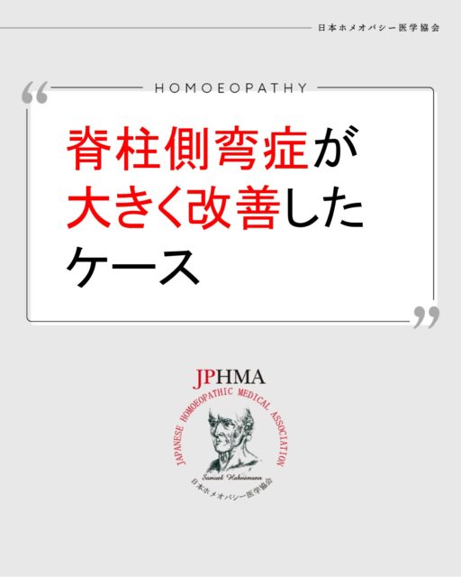 本ケースは第27回JPHMAコングレスへ森下千秋ホメオパス（日本ホメオパシーセンター湘南藤沢鵠沼）より寄せられた「女子中学生の脊柱側弯症が​大きく改善したケース」をまとめたものです。

クライアントは中学に入学後、側弯症の診断。医師からはコルセットを勧められましたが、あまり使用することもなく、ホメオパシーの相談を選択されました。
森下ホメオパスは骨が弱くなる原因と考えられる成育歴や体質から見て取れる肉体面へのアプローチだけでなく、家系的なカルマやペットの猫の事故死などとの関連も考慮して、霊性的アプローチも同時に行い、医師からもコルセットをする必要がないかもしれないと言われる程、側弯が大きく改善した素晴らしケースでした。

詳細は「CHhomオンラインショップ」で11/30までアーカイブ配信中の第27回JPHMAコングレス一日目（https://ec.homoeopathy.ac/index.php/product/6509）でご視聴いただけます。

ぜひZENホメオパシーにできること、その可能性をご覧ください。

#側弯症改善 　#ミルク育児 　#熱性けいれん持ち 　#腎の気 　#骨軟化症 　#くる病 　#ホメオパシー #jphmaコングレス